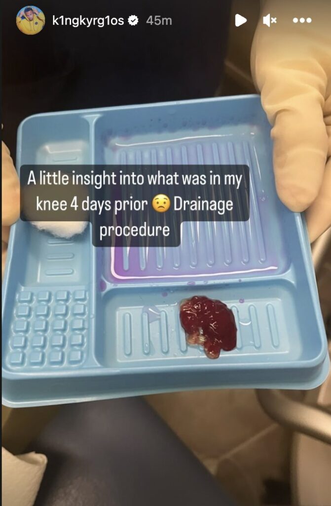 Kyrgios shows his injury insides on social media.